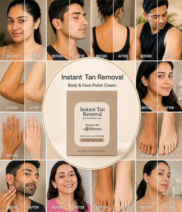 Instant Tan Removal Cream – De-Tan | Kojic Acid, Glutathione | Ph Balanced Reduces Tan under 20 Minutes (125g)