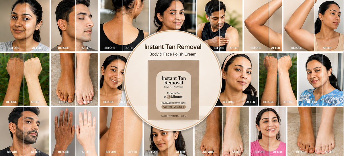 Instant Tan Removal Cream – De-Tan | Kojic Acid, Glutathione | Ph Balanced Reduces Tan under 20 Minutes (125g)