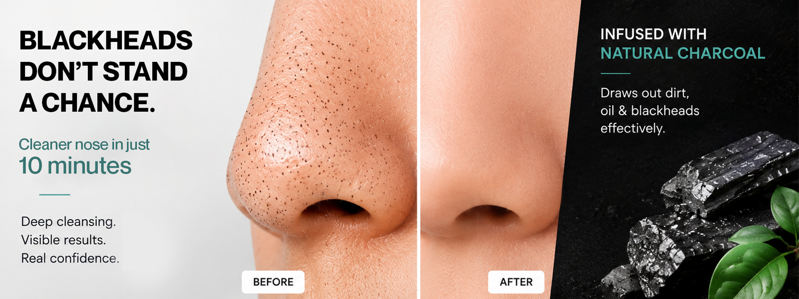 Strip Talks Charcoal Nose Strips for Blackhead Removal