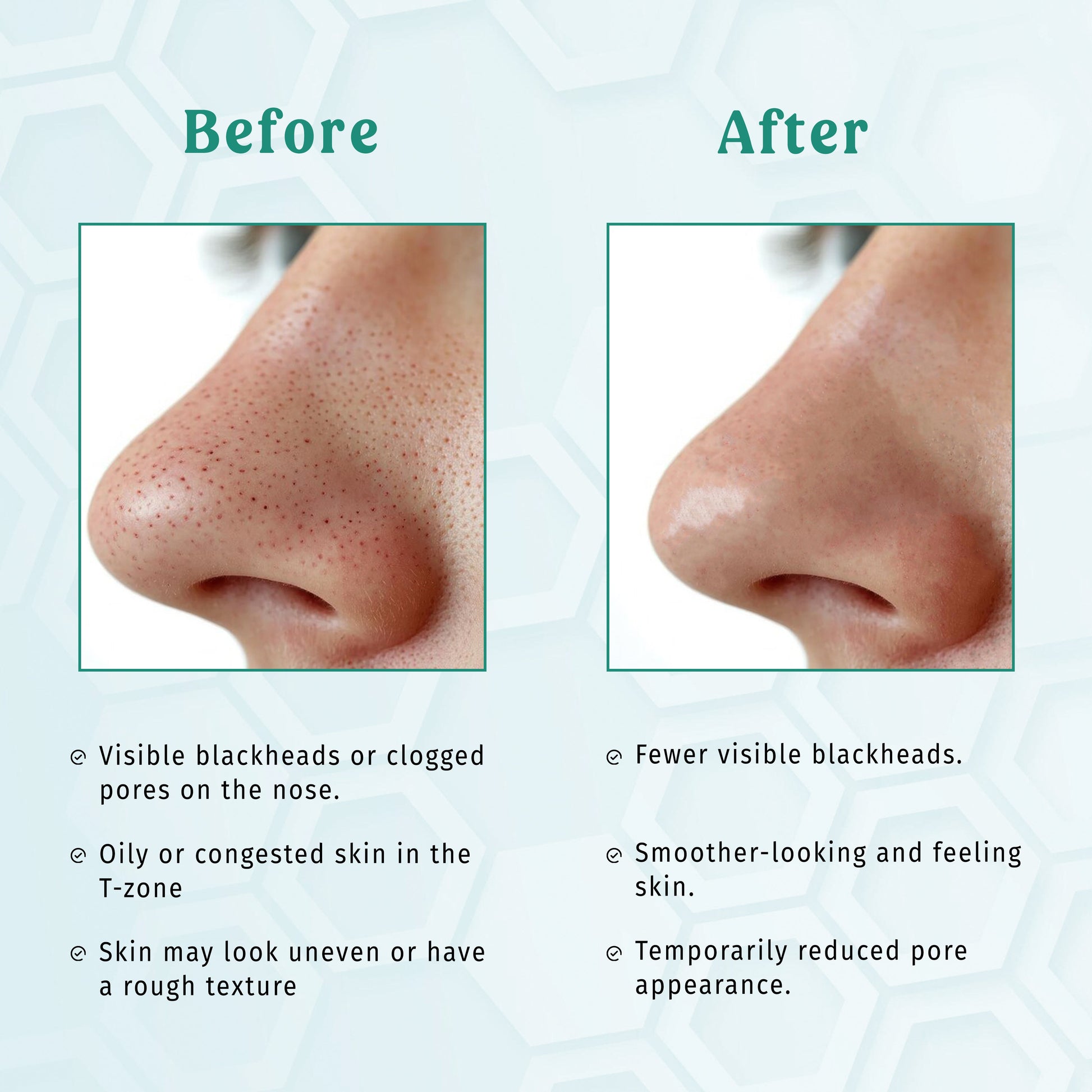 Nose Strips – Strip Talks The Bath and Care