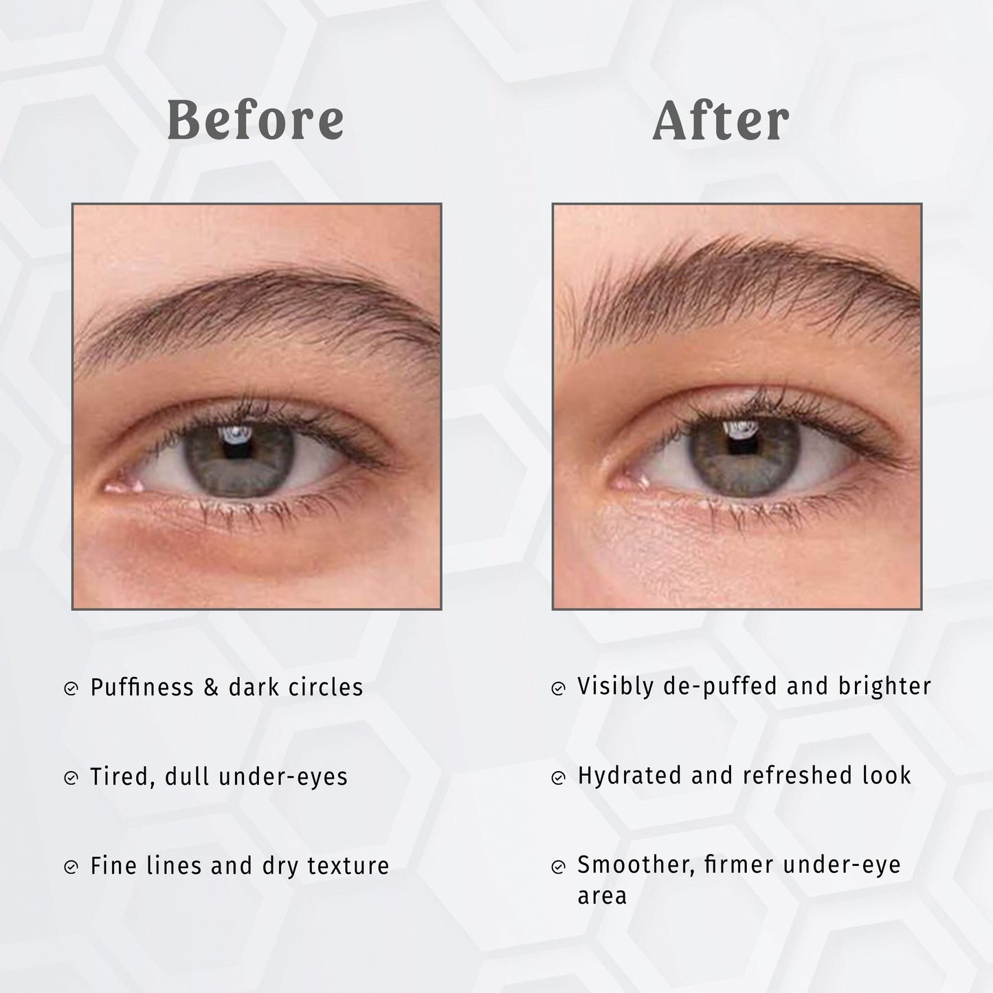 Under Eye Patches – Pearl E-Care The Bath and Care
