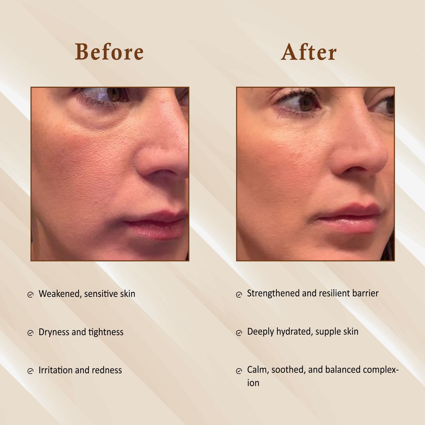 BIO BARRIER - BARRIER REPAIR AMPOULE The Bath and Care