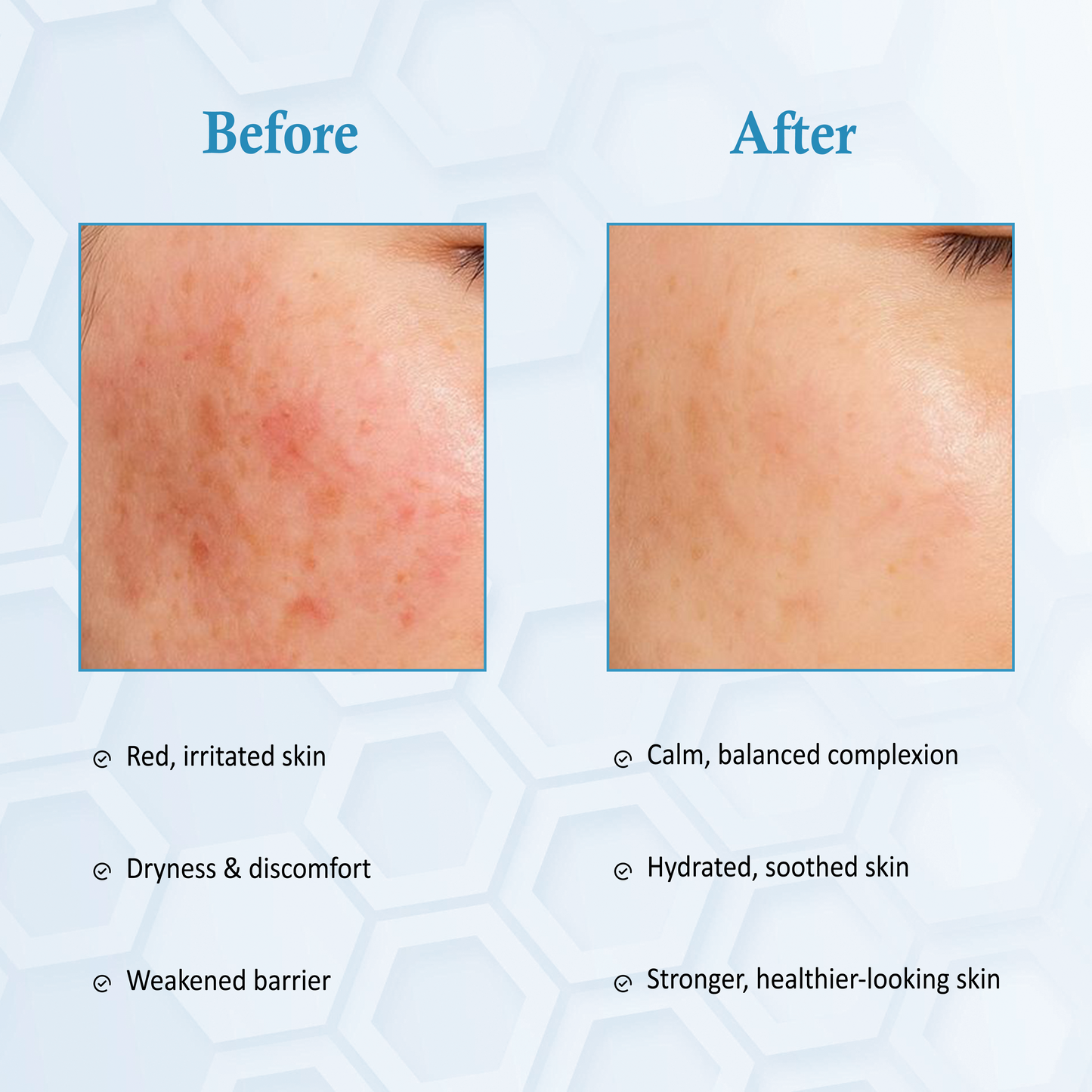 CENTI SOOTH - INTENSE SOOTHING AMPOULE The Bath and Care