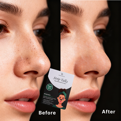 Deep Cleansing Charcoal Nose Strips - Nose Blackheads & Pores Remover - Strip Talks The Bath and Care