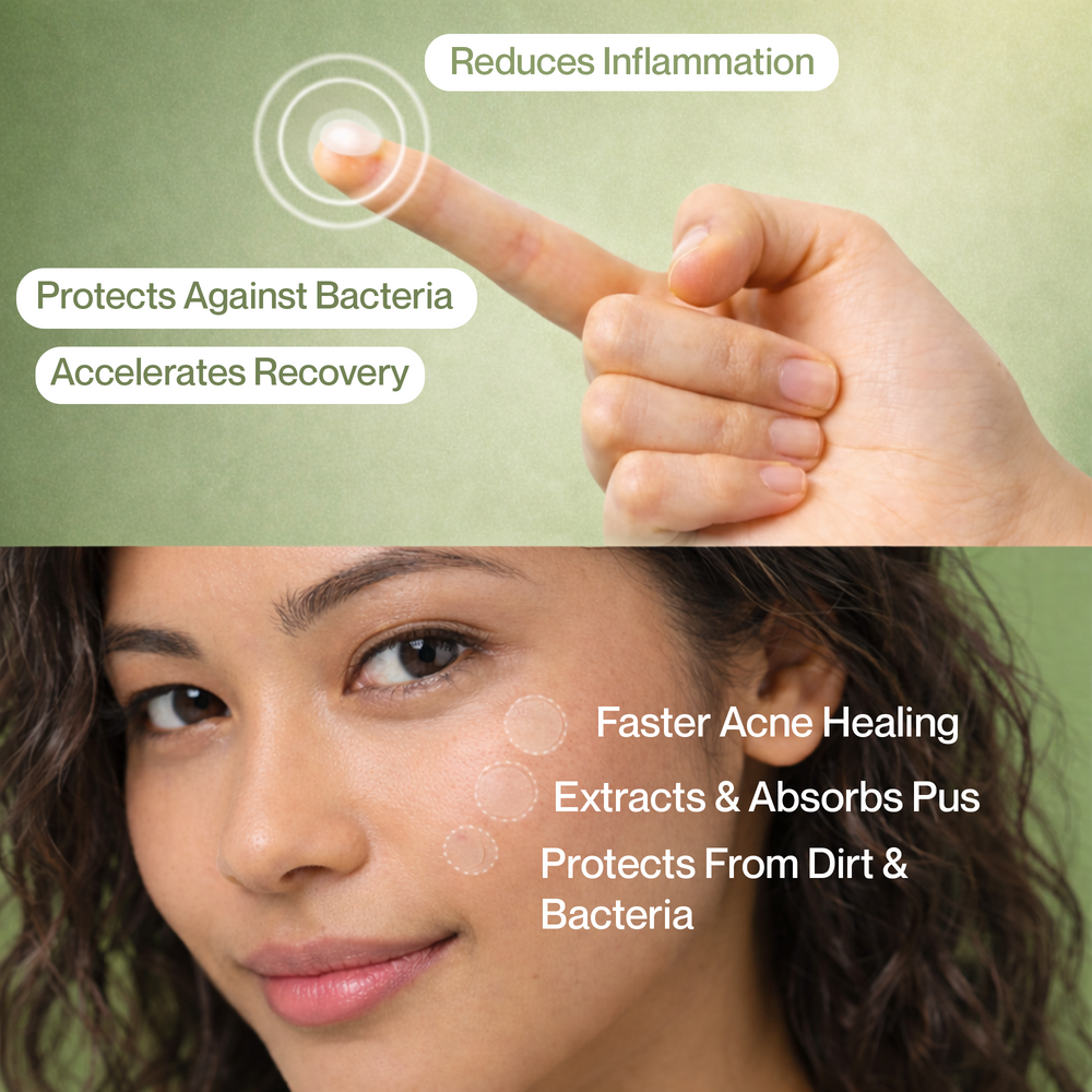 Clear Cue Acne Patches â€“ Overnight Pimple Solution with Hydrocolloid Technology The Bath and Care