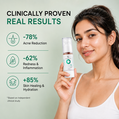 Acne Away Gel â€“ Anti Acne Face Gel with Aloe Vera, Tea Tree, Clove Oil, Peptides & Ceramides The Bath and Care