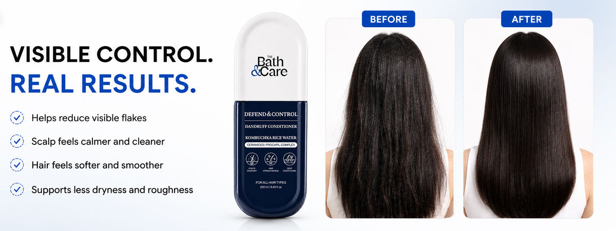Kombuchka Rice Water Anti-Dandruff Conditioner – Defend & Control for Flaky, Oily Scalp, Helps Reduce Dandruff, Scalp Flakes & Excess Oil