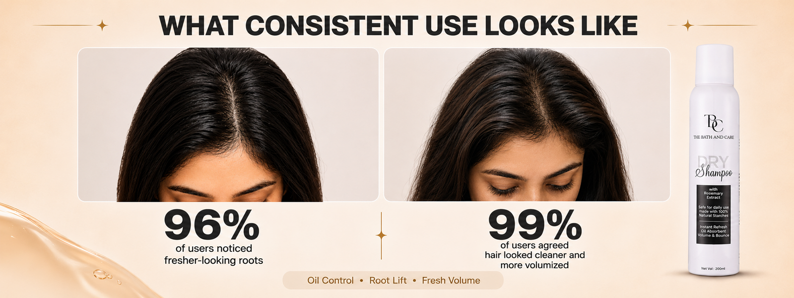 Rosemary Waterless Dry Shampoo for Oily Scalp & Instant Refresh | 200ml