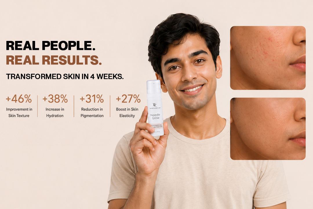 Needle Glow Exosome-Infused Skin Booster