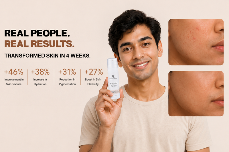 Needle Glow Exosome-Infused Skin Booster