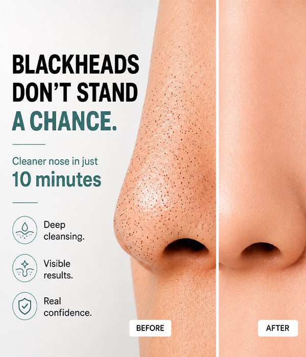 Strip Talks Charcoal Nose Strips for Blackhead Removal