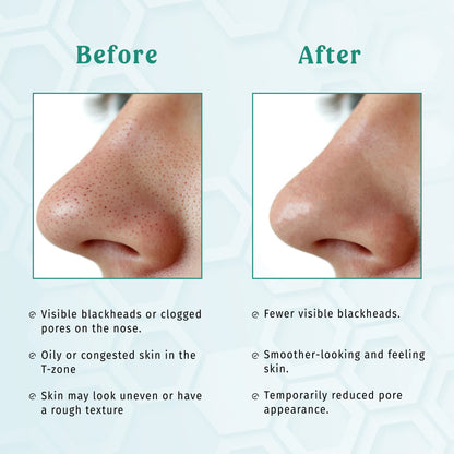 Nose Strips – Strip Talks The Bath and Care