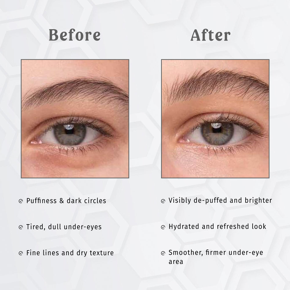 Under Eye Patches – Pearl E-Care The Bath and Care