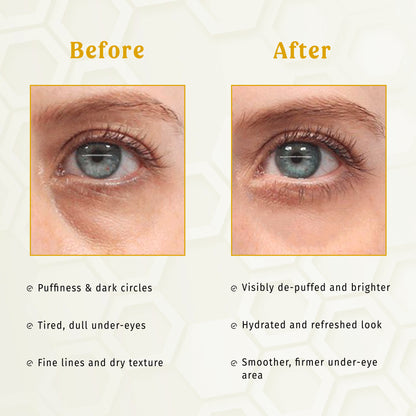 Under Eye Patches - Gold E-Care The Bath and Care