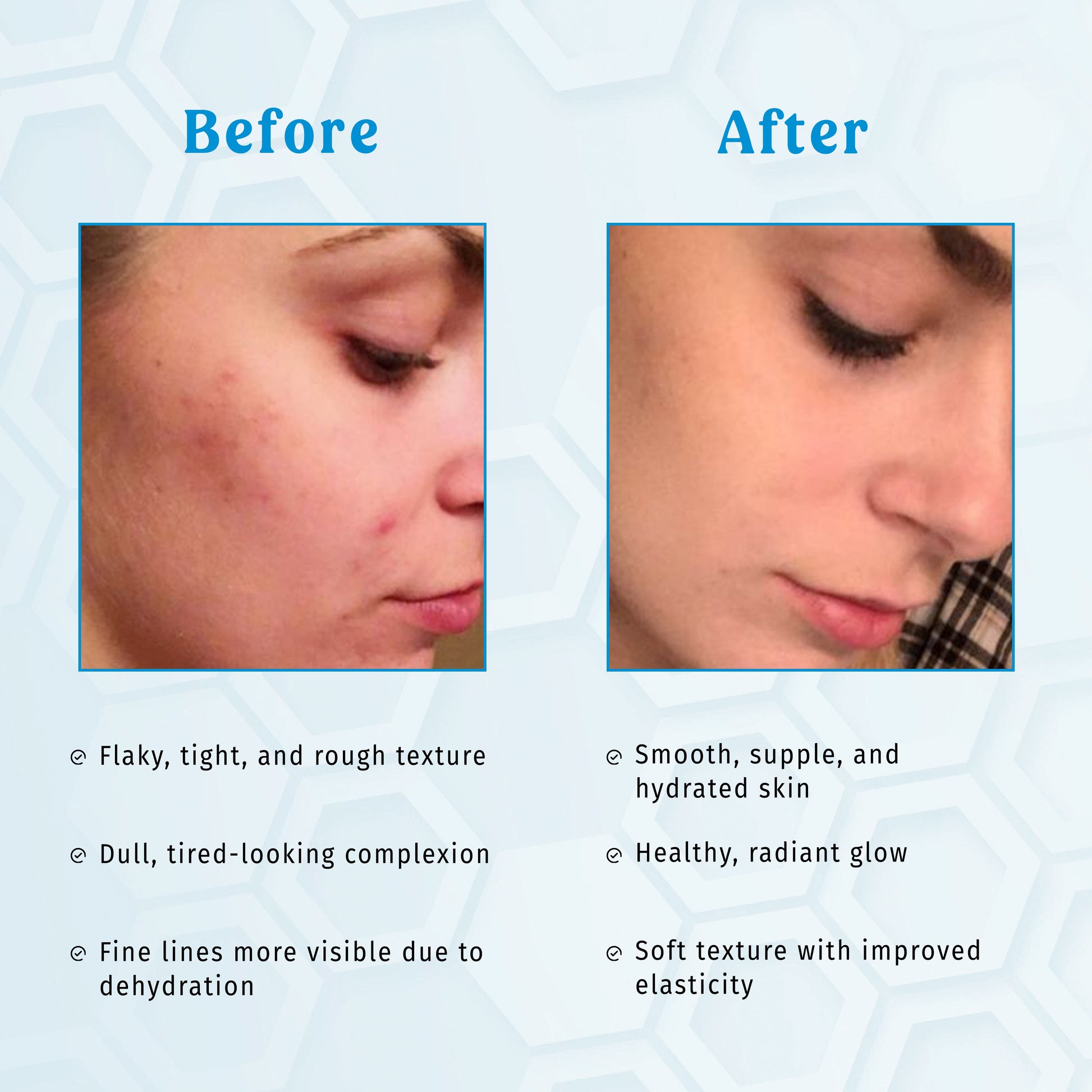 Moisturizing Face Wash & Cleanser With Hyaluronic Acid - Aqua Revive The Bath And Care