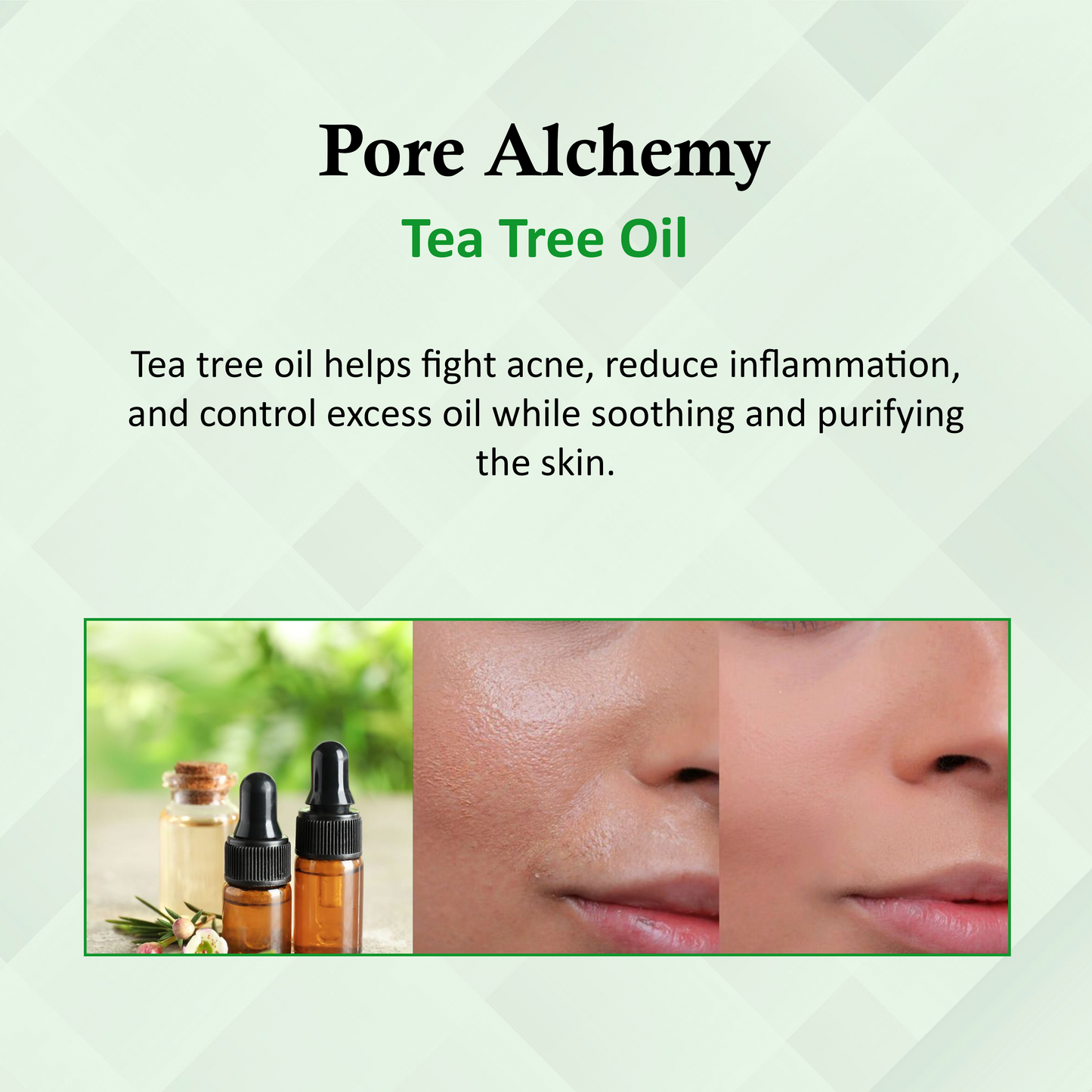 Pore Minimizing & Oil Control Face Serum for Anti Acne The Bath and Care