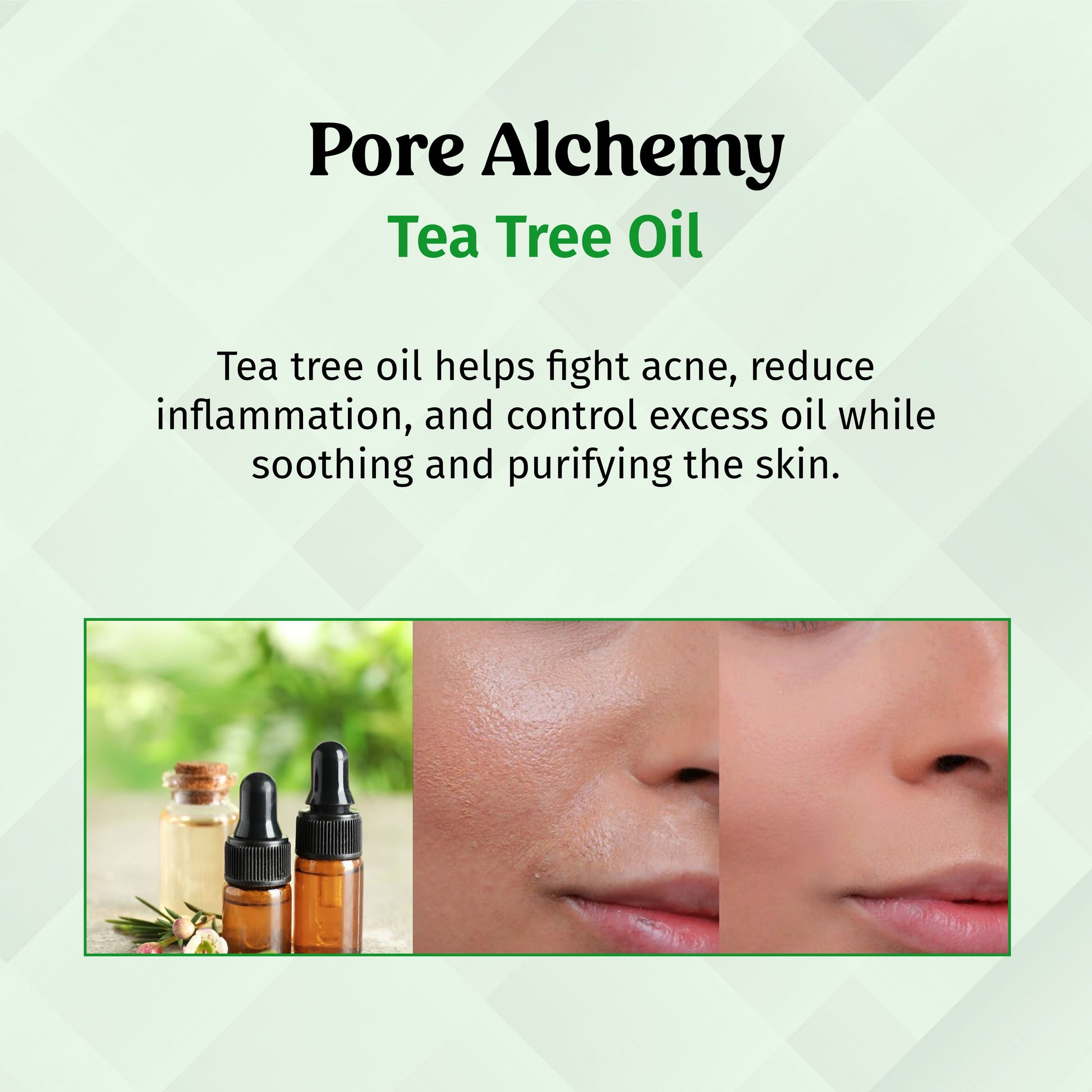 Aloe Vera & Oil Control Face Gel for Pore Minimizer The Bath and Care